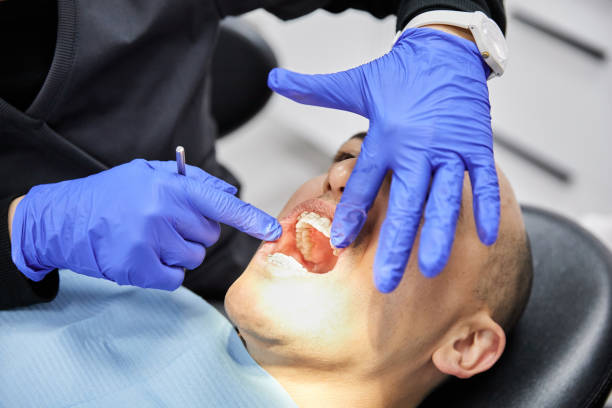 Best Emergency Treatment for Oral Infections in Cameron, WI
